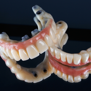 Dental Bridge